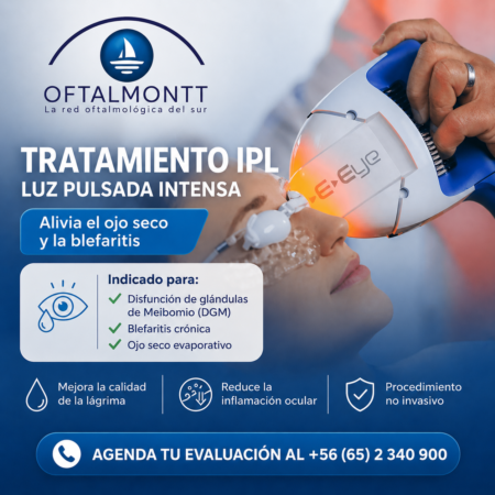 Tratamiento IPL Oftalmontt